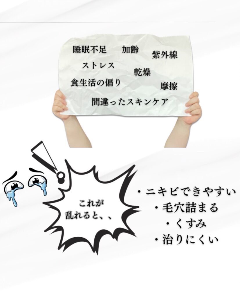 ターンオーバーが乱れる原因（紫外線・ストレス・睡眠不足）と、それによって引き起こされるニキビや毛穴詰まりのトラブル例。