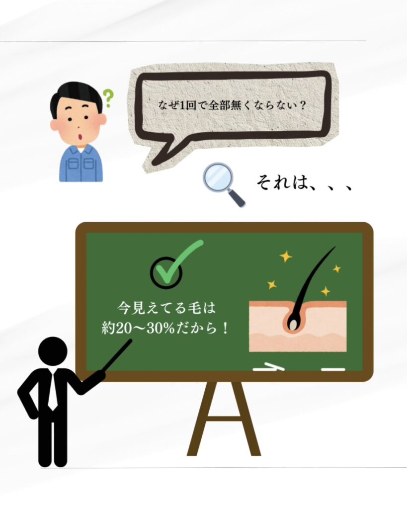 メンズ脱毛の仕組み解説。今見えている毛は全体の約20〜30%であり、毛周期に合わせて複数回の施術が必要な理由の図解。