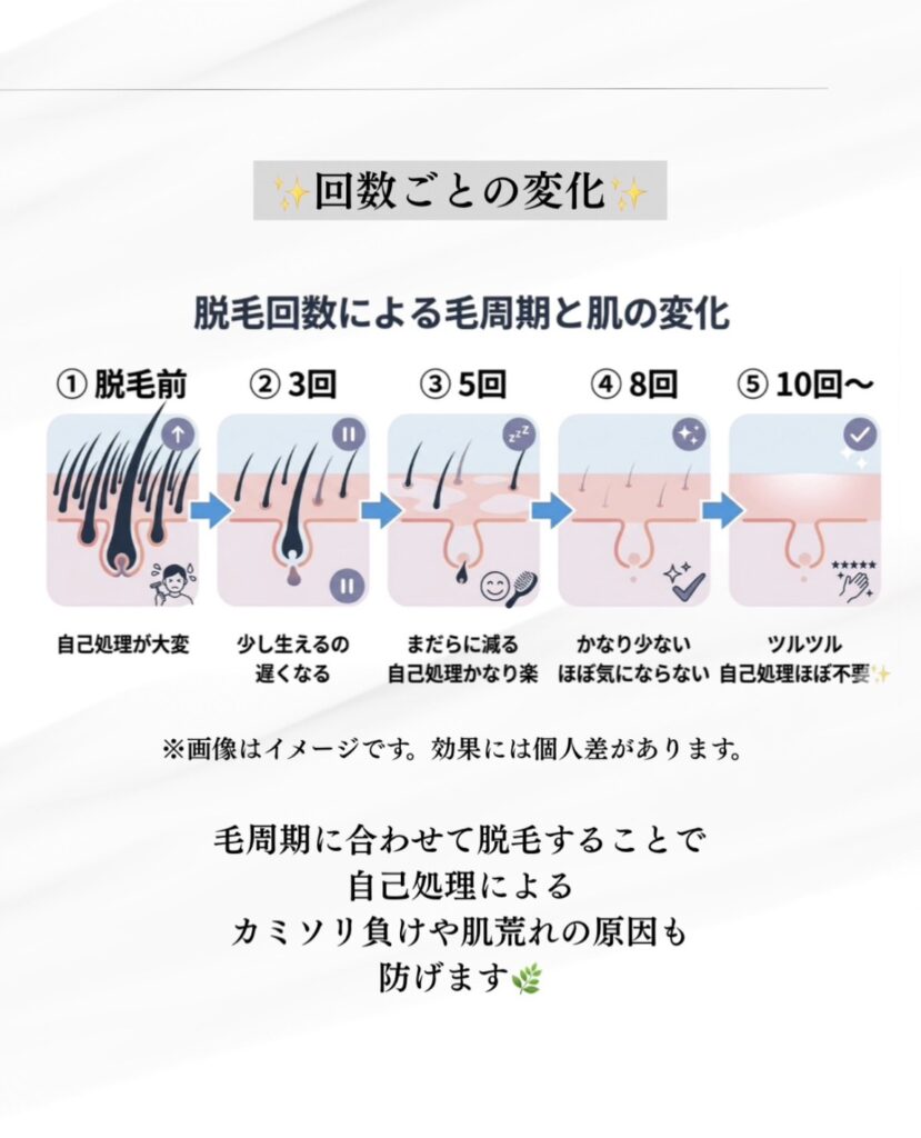 ヒゲ脱毛の回数による毛周期と肌の変化イメージ図。1〜3回目から10回目以降までの、自己処理の頻度やヒゲの密度の変化。