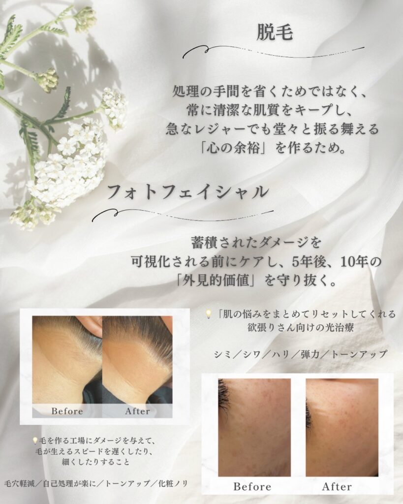 Classy&TrueMe印象管理専門店のフォトフェイシャルと脱毛をした写真、変化が一目でわかるくらいに綺麗になってます。