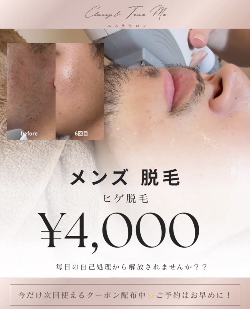 名護市Classy＆TrueMeのメンズ脱毛メニュー(ヒゲ脱毛１回4,000円)の料金案